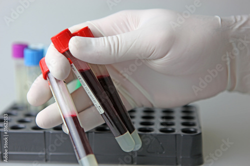 Photo: Scientist working at the laboratory Scientist working at the laboratory