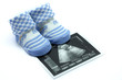 Baby shoes and Ultrasound  images