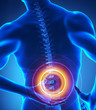 Backbone injury x-ray view
