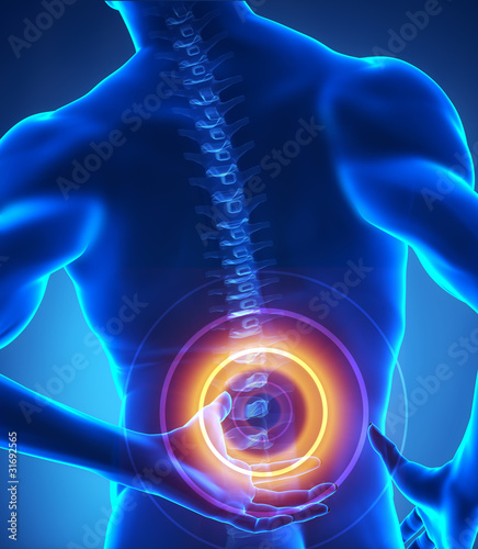 Ilustración: Backbone injury x-ray view Backbone injury x-ray view