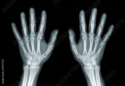 Photo: Roentgenogram Roentgenogram