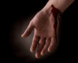 Suicide attempt - Bleeding wrist of human hand