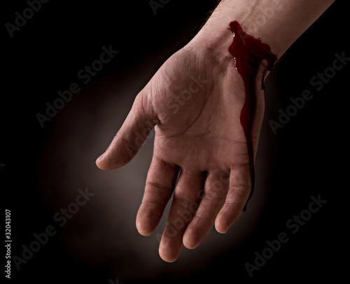 Photo: Suicide attempt - Bleeding wrist of human hand Suicide attempt - Bleeding wrist of human hand