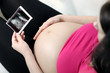 Photo: Pregnant woman with ultrasound photo Pregnant woman with ultrasound photo