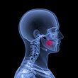 Head with symbolized toothache.