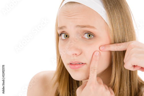 Photo: Acne facial care teenager woman squeezing pimple Acne facial care teenager woman squeezing pimple