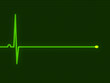 cardiogram