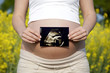 Ultrasound scan