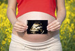 Pregnant woman holding ultrasound scan