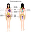 Referred pain chart, eps8