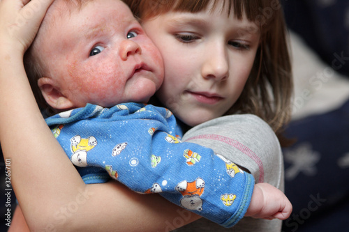 Photo: Girl embraces her brother Girl embraces her brother
