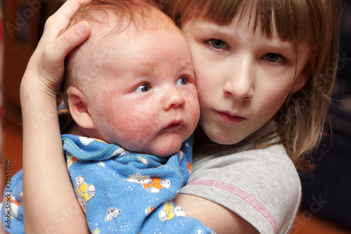 Photo: Girl pitied her brother Girl pitied her brother