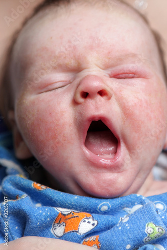 Photo: Yawning Baby Yawning Baby