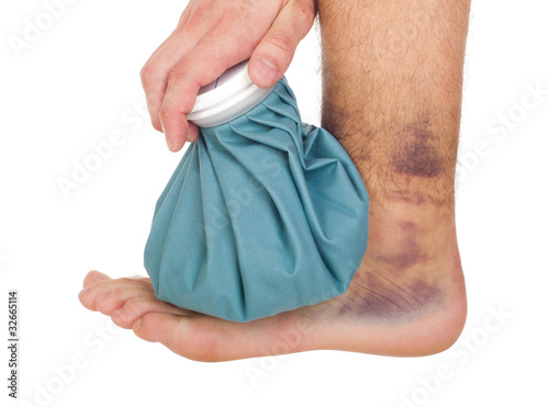 Photo: Icing a sprained ankle Icing a sprained ankle