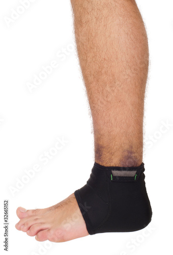 Photo: Ankle sprain support Ankle sprain support
