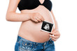 Foto: Schwangere mit Ultraschallbild Schwangere mit Ultraschallbild