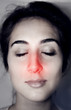 Photo: Red Nose Red Nose