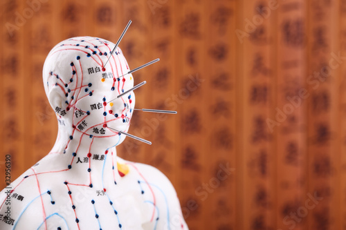Photo: Eastern or Asian acupuncture Medical Treatment. Eastern or Asian acupuncture Medical Treatment.