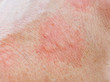 Allergische Reaktion