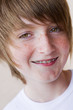 Appareil dentaire orthodontiste