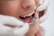 Patient receiving dental treatment