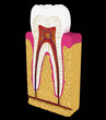 Dentistry: Tooth cut or section Dentistry: Tooth cut or section