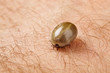 Foto: Tick Tick