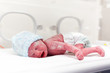 Photo: Newborn boy covered in vertix in incubator Newborn boy covered in vertix in incubator