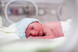 Photo: Newborn boy covered in vertix in incubator Newborn boy covered in vertix in incubator