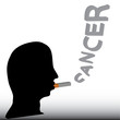 Smoking cancer