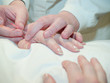 Acupuncture Concept