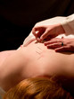 Acupuncture Concept