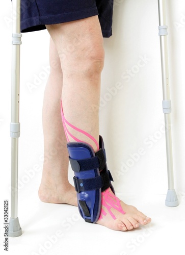 Photo: orthopedic ankle contusion orthopedic ankle contusion