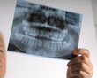 roentgen of teeth