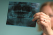 roentgen of teeth
