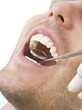 Examining patient's teeth