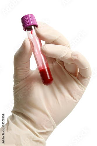 Photo: Blood container in hand with glove Blood container in hand with glove