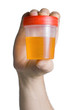 Urine Container Urine Container