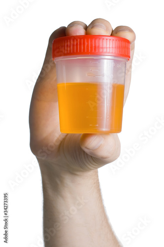 Photo: Urine Container Urine Container