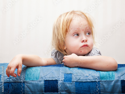 Photo: a sick girl is sitting near the bed a sick girl is sitting near the bed