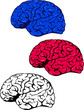 Human brain