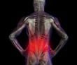 X-ray illustration of male human lower back pain pain.