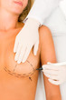 Plastic surgery doctor draw line patient breast