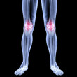 leg