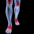 leg
