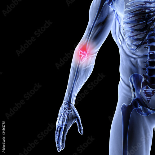 Illustration: arm arm
