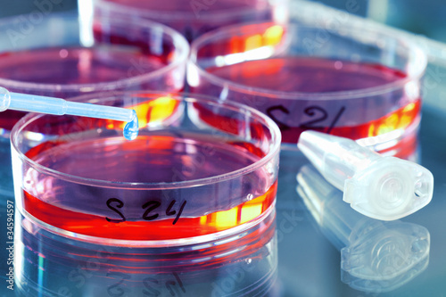 Photo: Bacteria research Bacteria research