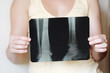 Woman holding an x-ray image