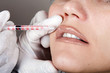 doctor making Botox injections in her lips