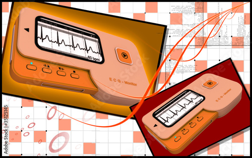 Illustration: ECG ECG